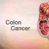 Colon Cancer