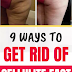 9 Ways to Get Rid of Cellulite Fast