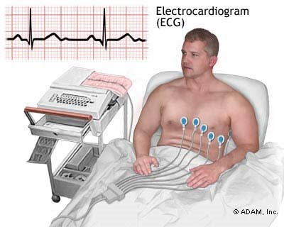 image electro cardiogram