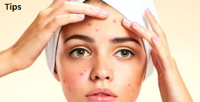 Remove Blackheads from household remedies