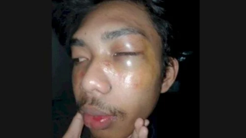 Seorang Mahasiswa di Makassar Babak Belur saat Ikut Aksi