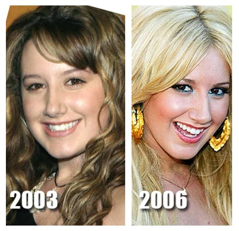 ashley tisdale nose job before after. Ashley Tisdale Nose Job