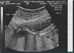 ultrasound_0001