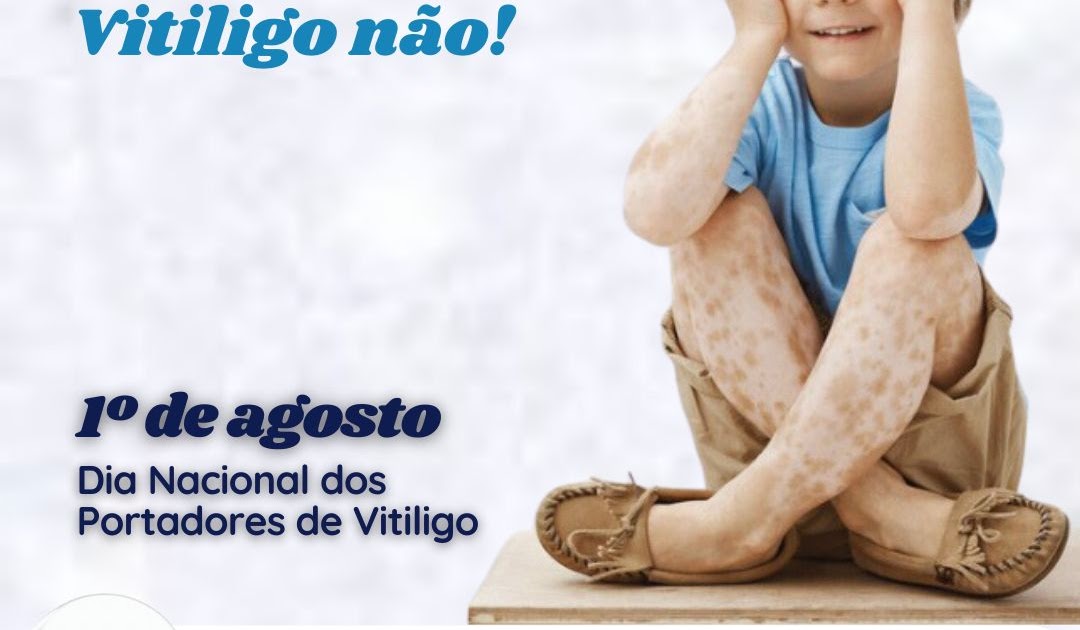 1 de agosto. Dia nacional dos portadores de vitiligo - OncoExpress