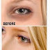 How To Remove Dark Circles Under your Eyes