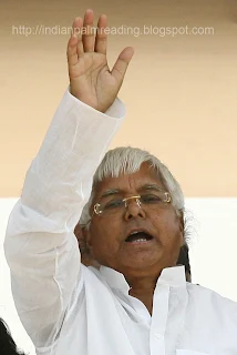 Sun Line & Fate Line On Hand Of Lalu Parasad Yadav Palmistry 