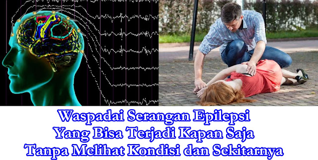 pengobatan tradisional epilepsi