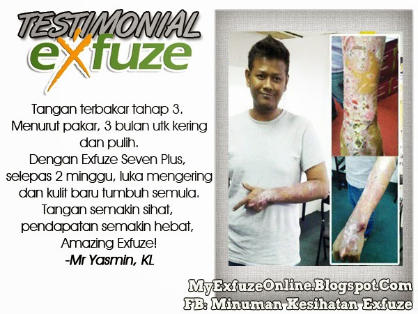 My Exfuze Online: Supplement, Kesihatan, Perniagaan 