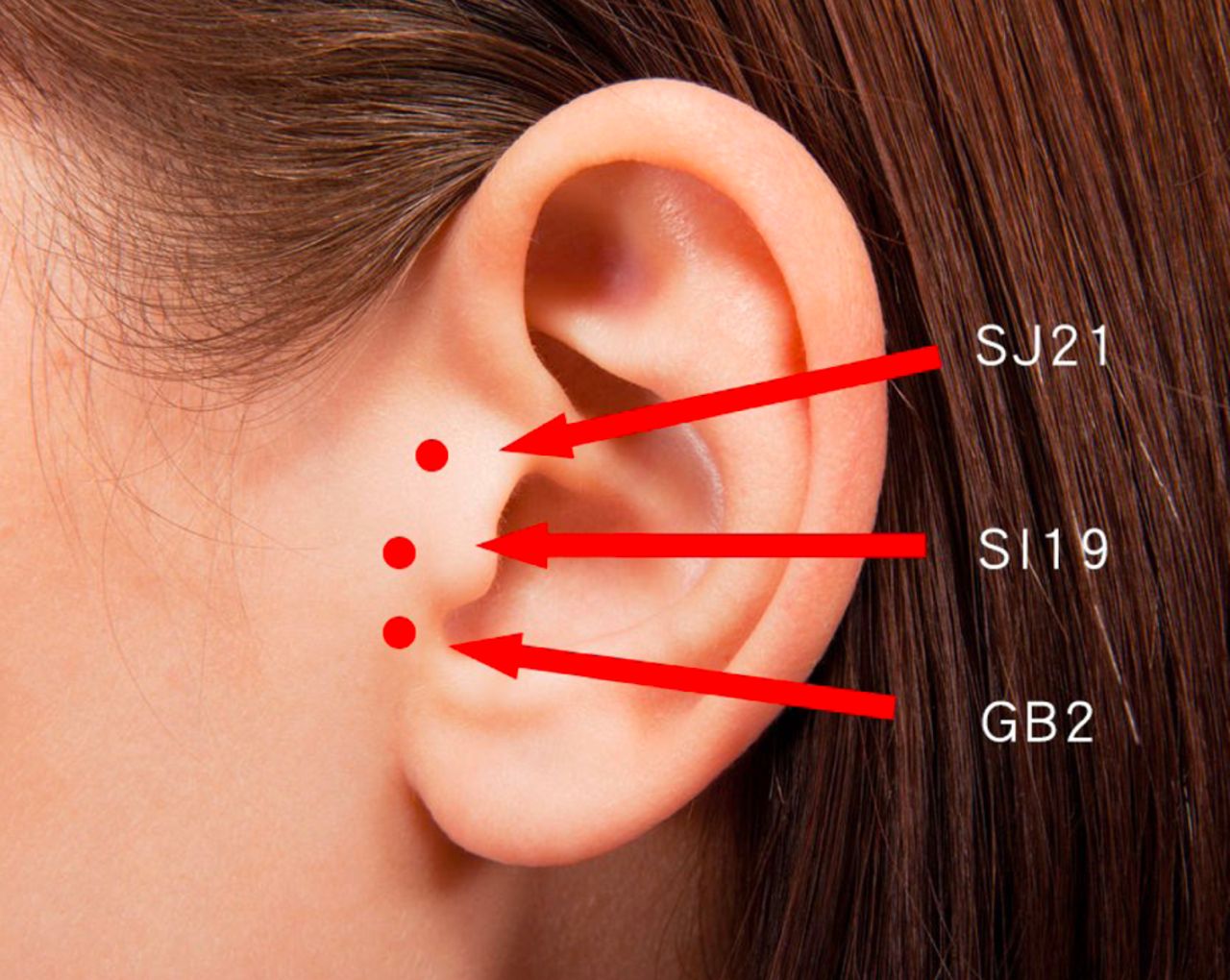 Tinnitus, Hearing loss and Acupuncture WDDTY | Southwell Acupuncture Clinic