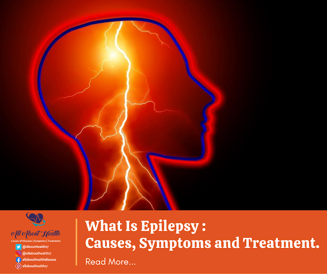 What Is Epilepsy : Causes, Symptoms and Treatment.