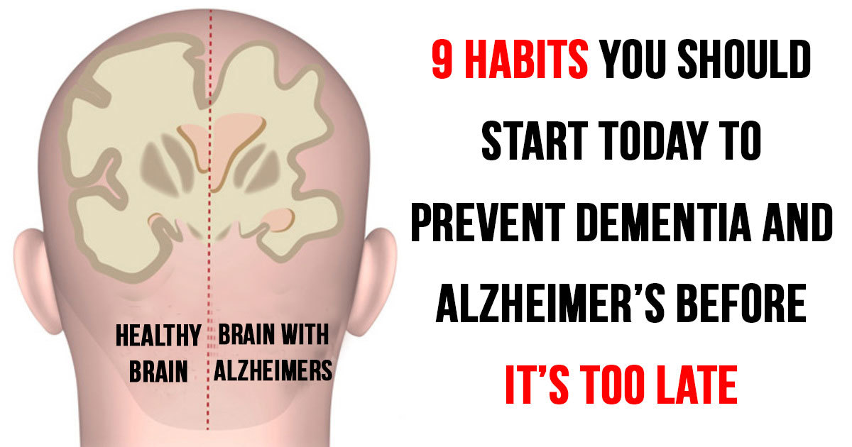 9 Habits You Need To Take Today To Stop Alzheimer's Disease Before It Starts