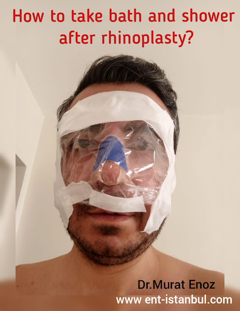How to take bath and shower after rhinoplasty?