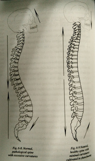 Proper spine alignment and posture