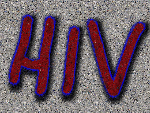 hiv aids,hiv,aids
