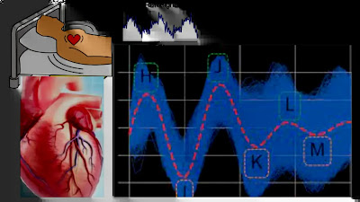 What Is Ballistocardiography