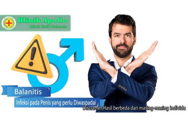 Balanitis Infeksi pada Penis yang perlu Diwaspadai