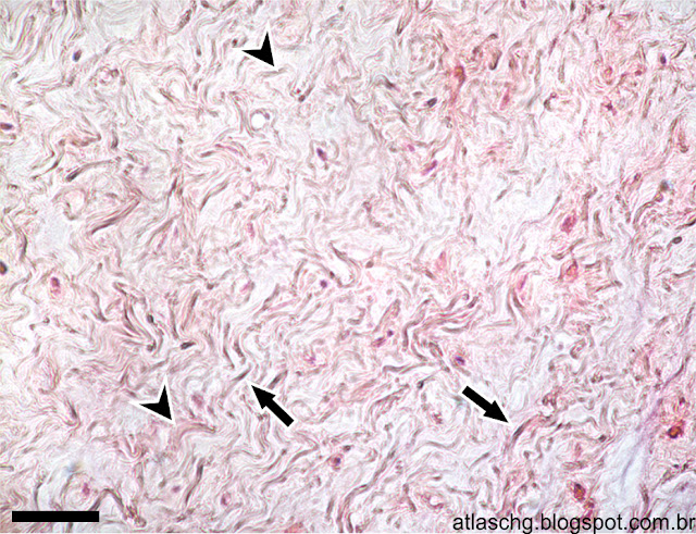 Corte de cordão umbilical - Tecido conjuntivo mucoso