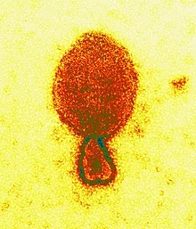 Micrografia eletrônica de transmissão colorida de um virion Heandra henipavirus (cerca de 300 nm de comprimento)