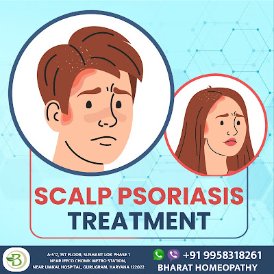 Scalp psoriasis treatment by homeopathy