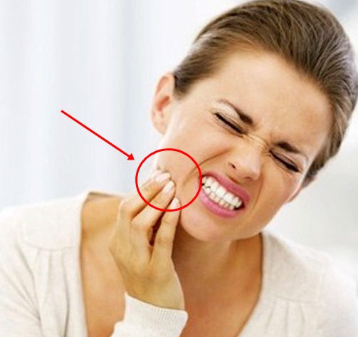Tips Ampuh Menghilangkan Ngilu Pada Gigi Sensitif Secara Alami