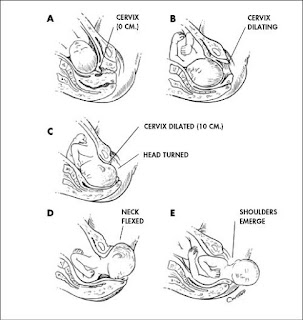 Home Remedies to Induce Labor
