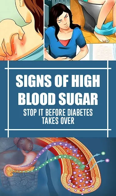 Indications of High Blood Sugar: Stop It Before Diabetes Takes Over