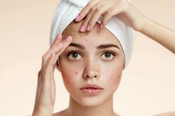 Home Made Acne-Fighting Face Wash