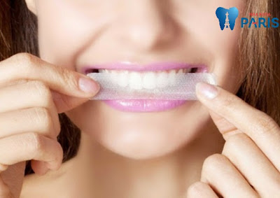 Lợi ích của miếng dán trắng răng là gì?