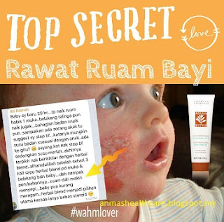 testimoni ruam muka bayi