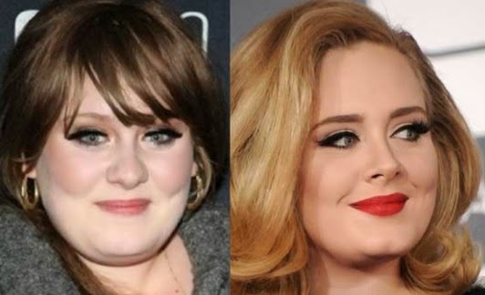 Adele Nose Job (Rhinoplasty) Before And After!