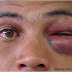 Golpes Mortais- A verdade além dos mitos das artes marciais!
