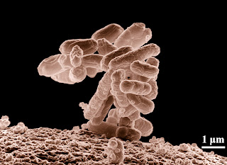 Escherichia coli kümesinin elektron mikroskobunda 10.000 kere büyütülmüş görüntüsü