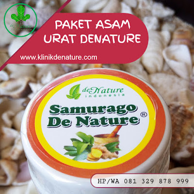 PENGOBATAN PENYAKIT ASAM URAT GOUT