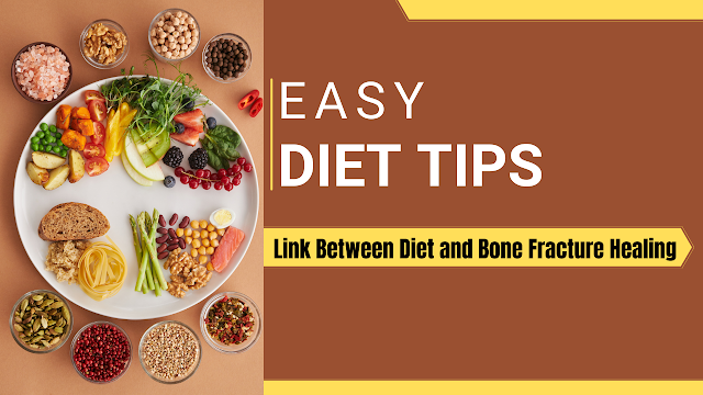 The Surprising Link Between Diet and Bone Fracture Healing: What You Need to Know