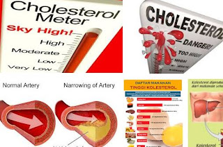 makanan kolesterol, pantangan kolesterol, saja pantangan penyakit kolesterol, penyebab kolesterol,obat kolesterol, penyebab kolesterol tinggi, kolesterol berbahaya, apa saja yang mengandung kolesterol