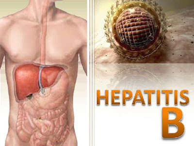 Symptoms And Treatment Of Hepatitis B | what is hepatitis b