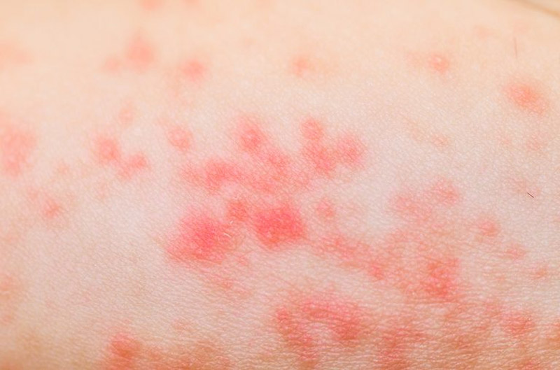 10 Skin Problems That Might Indicate a Serious Disease