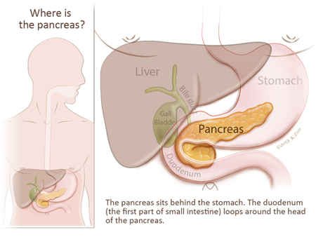 Ada Apa Dengan Ubat: Diabetes Mellitus. Kencing Manis 