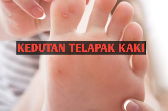 arti-kedutan-telapak-kaki