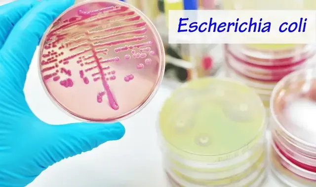 Microbial quality of wastewater