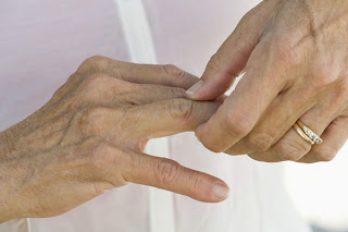 La artritis y el riesgo de enfermedades cardíacas