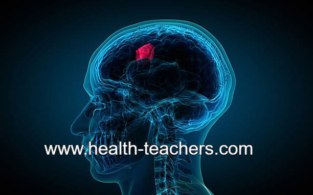 Is headache a symptom of any disease? Health-Teachers