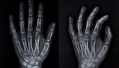 Huesos de la mano y biologia