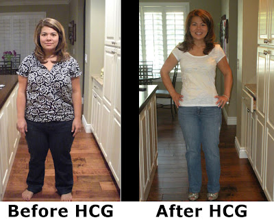 hcg drops before and after pictures. hcg drops before and after