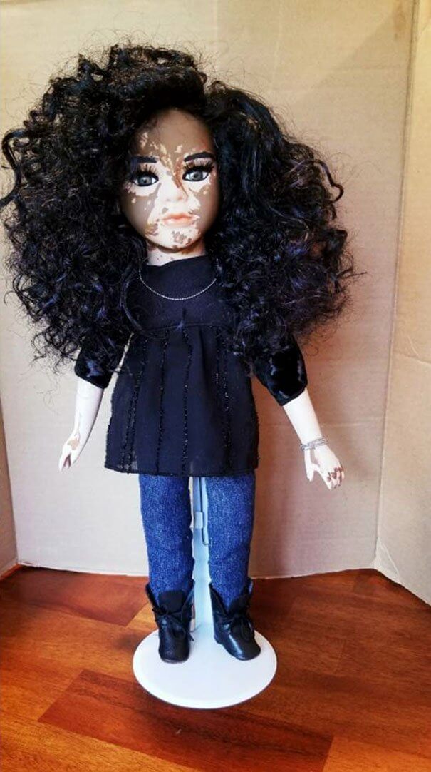 Artist Creates Dolls With Vitiligo To Support Children Who Have This Skin Condition