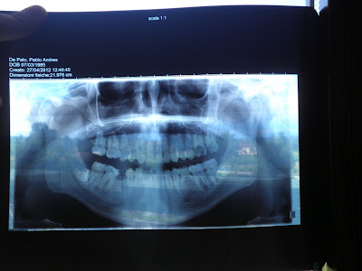 radiografia panoramica
