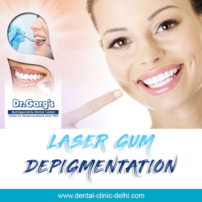 How to Get Laser Gum Bleaching in India?