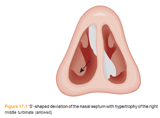 The nasal septum-17