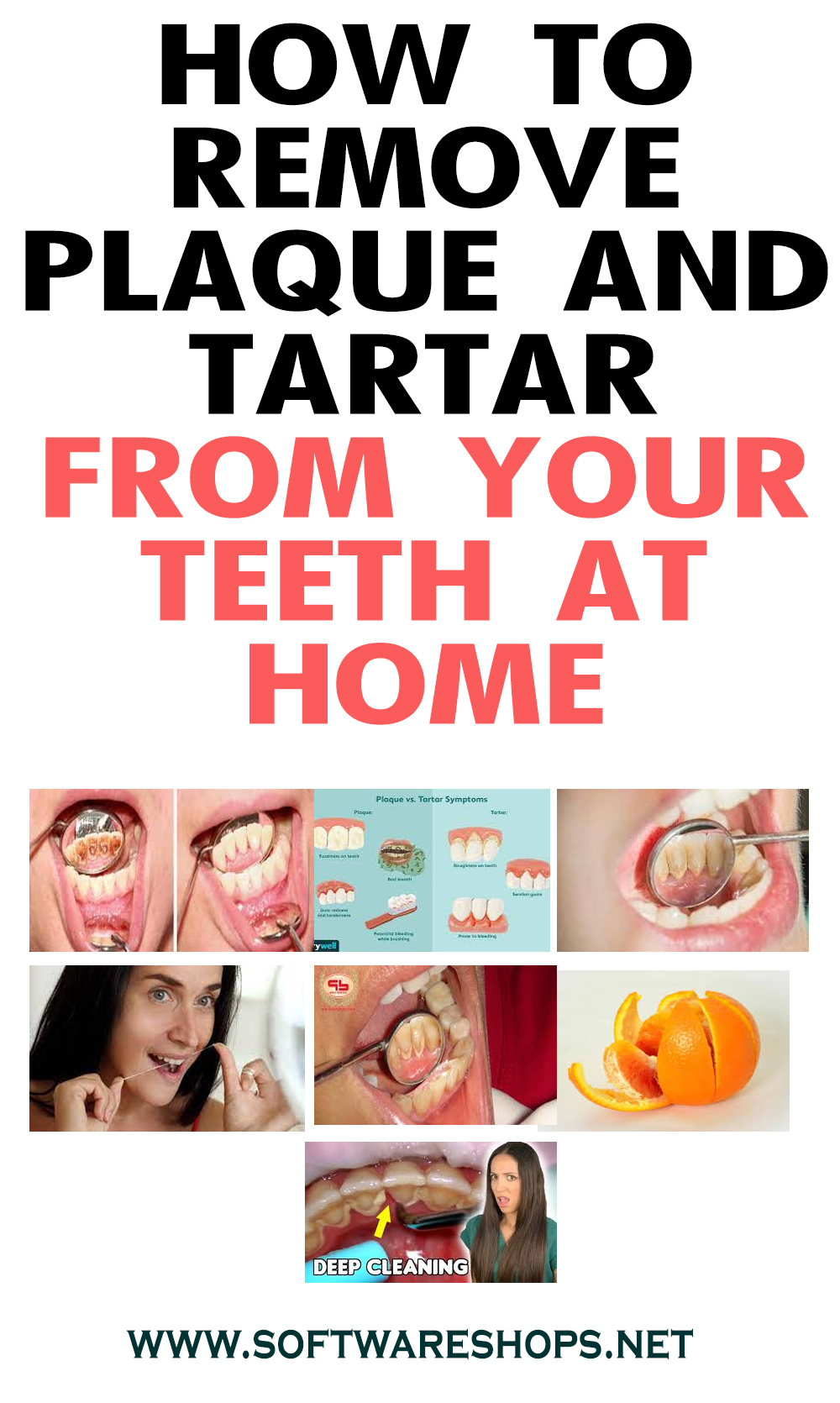 HOW TO REMOVE PLAQUE AND TARTAR FROM YOUR TEETH AT HOME