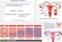 quels sont les symptome du cancer du col ?